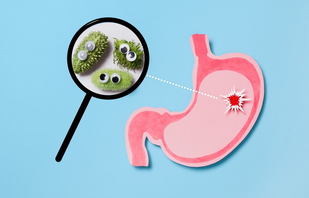 Probiotics and H. pylori: Supporting Stomach Health