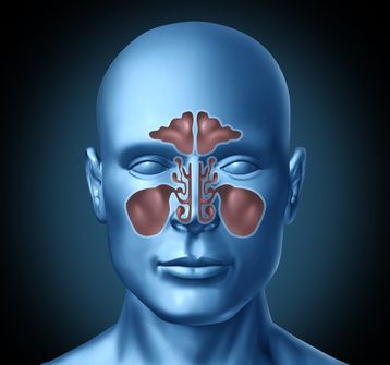 Is Your Sinusitis From a Fungus? No Wonder Antibiotics Don’t Help