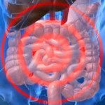 bowel