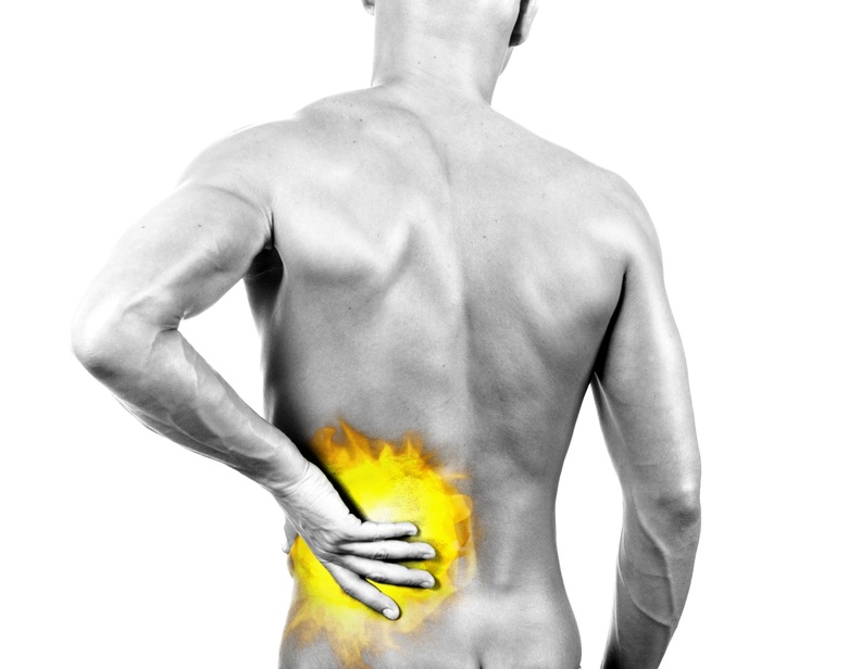 The Cost of Back Pain