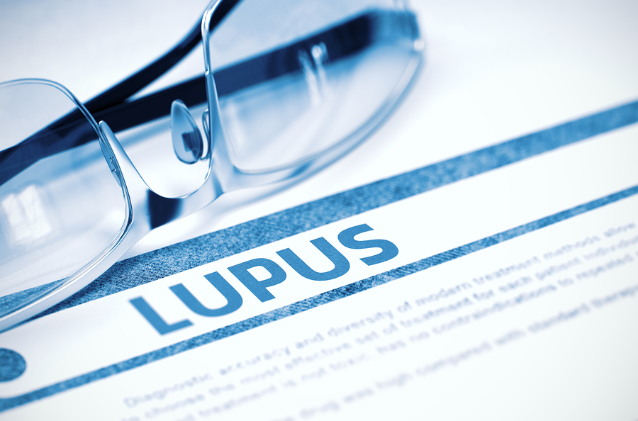 Lupus and Omega-3 Fatty Acids