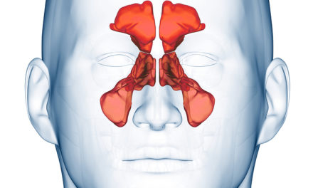 Catching a lot of Colds? Maybe it is Your Sinuses