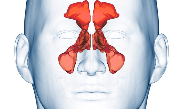 Catching a lot of Colds? Maybe it is Your Sinuses