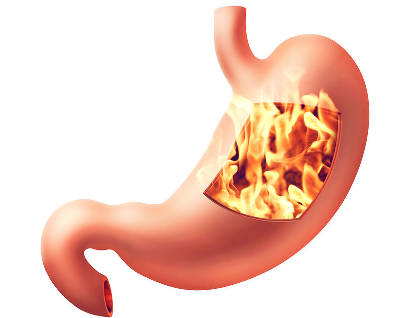 Anti Acid Medications may Aggravate Gastritis