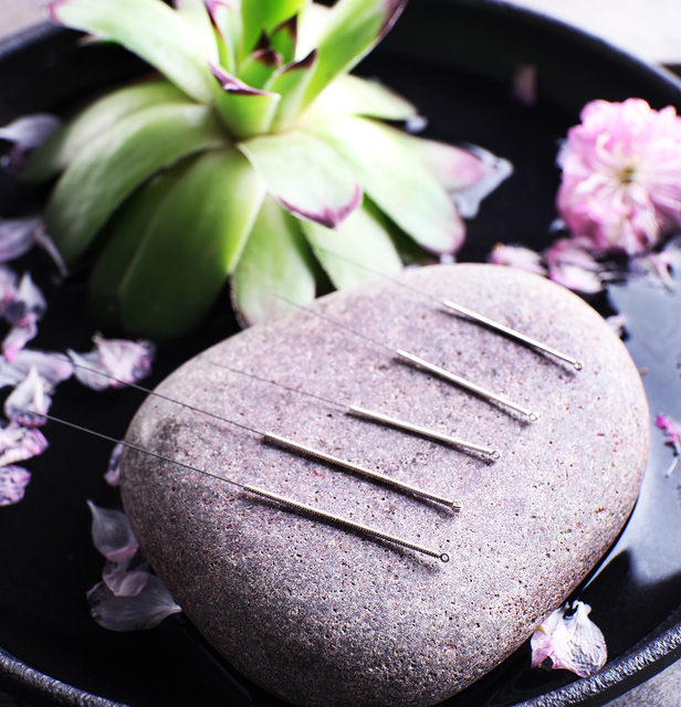 Acupuncture and Arthritis