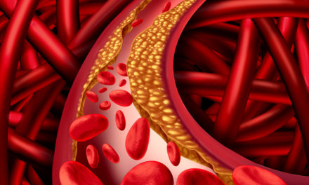 Arteriosclerosis and Vitamin K