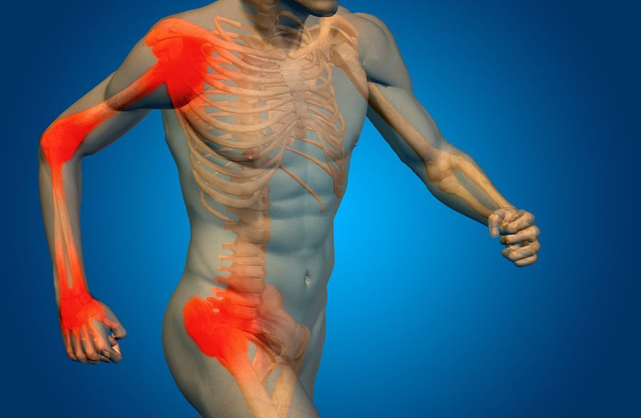 Glucosamine and Chondroitan: Beyond Arthritis