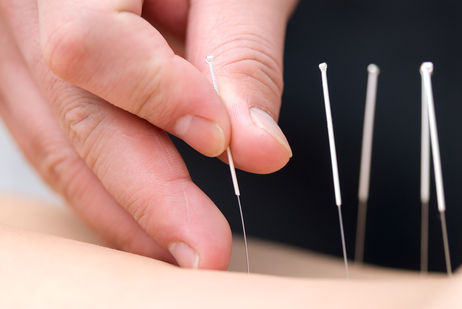 Depression and Acupuncture
