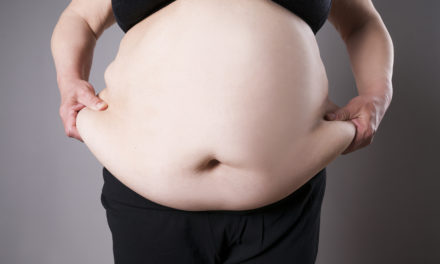 Obesity and Breast Cancer Risk