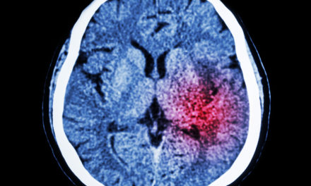 Nutrients Protect from Stroke