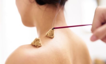 Acupuncture and Inflammatory Bowel Disease