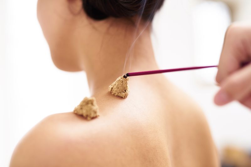 Acupuncture and Inflammatory Bowel Disease