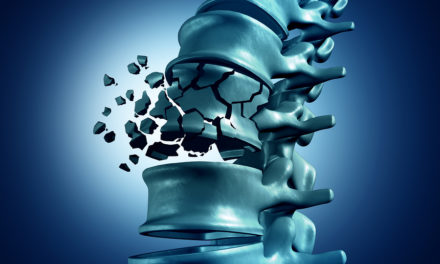 Osteoporosis and Vitamin K