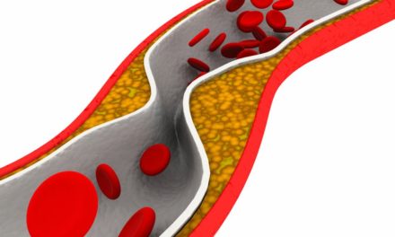 Trans Fatty Acids and Cardiovascular Disease