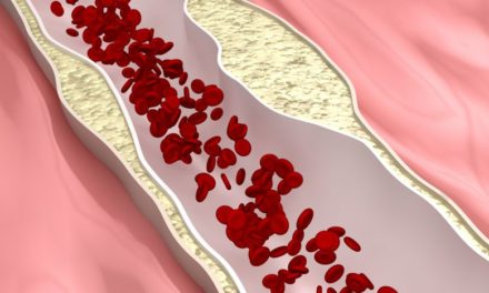 Vitamin D and Coronary Artery Disease