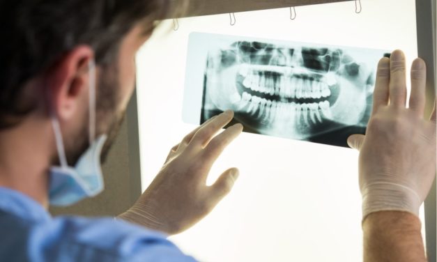 Migraines? Could it be Your Teeth?