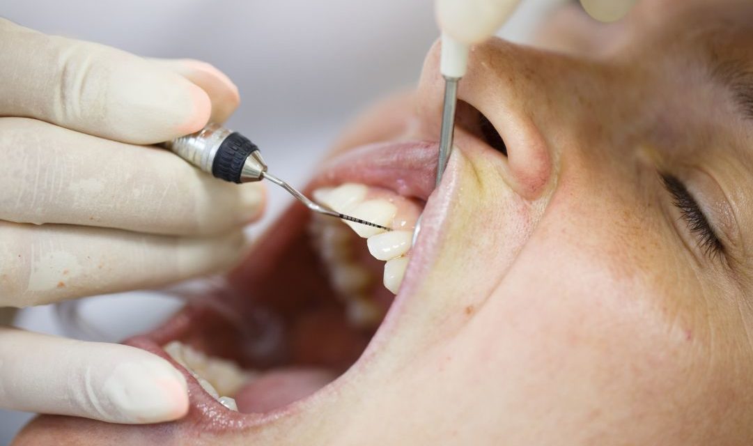 Vitamin C and Periodontal Disease
