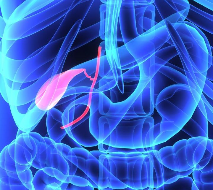 Vitamin C and Gallbladder Disease