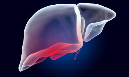 A Natural Approach to Hepatitis C