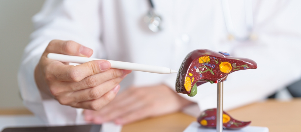 Fatty Liver: Early Signs, Risks, and Natural Support