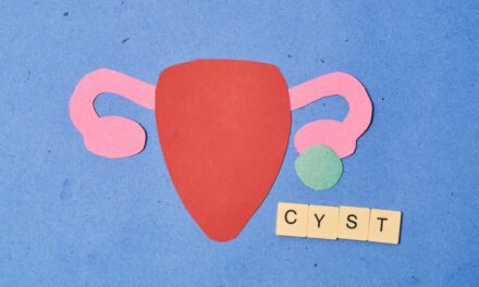 PCOS: Understanding and Managing Polycystic Ovary Syndrome