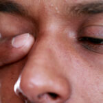 What to do About Itchy Allergy Eyes